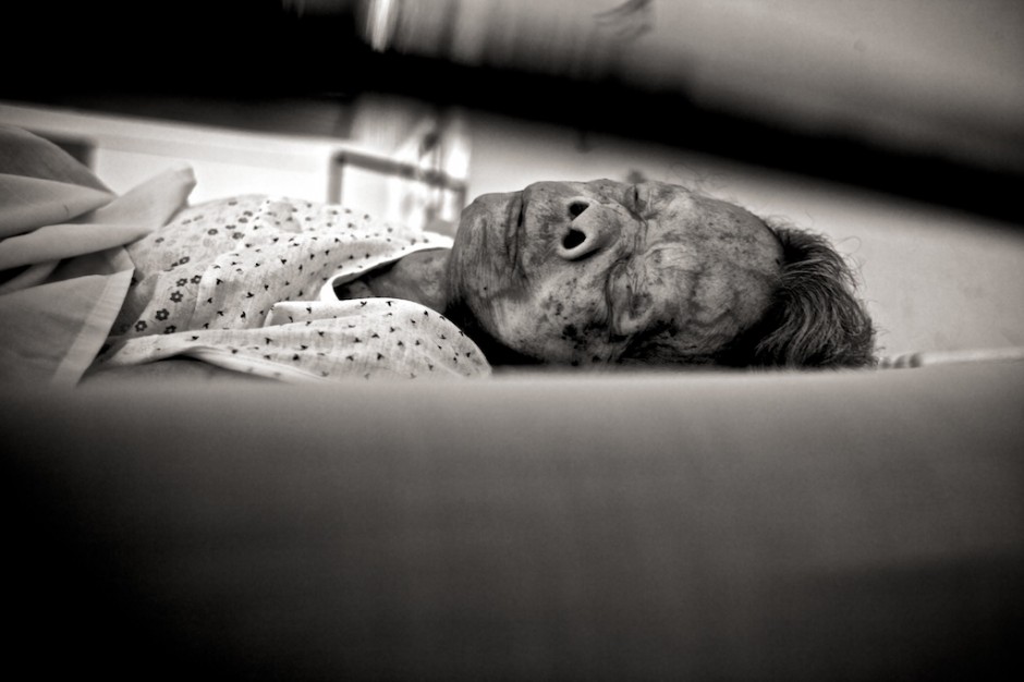 Leprosy patient