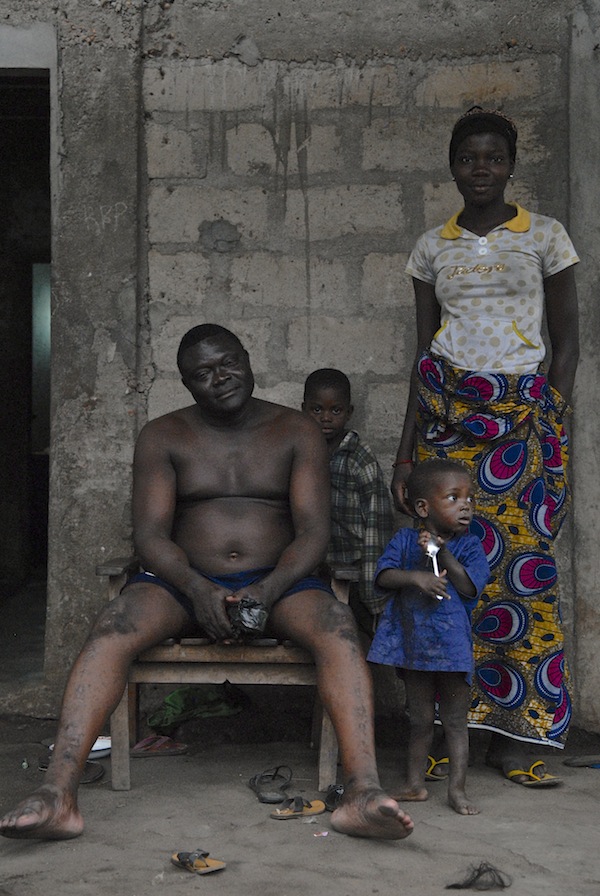 Benin (11)