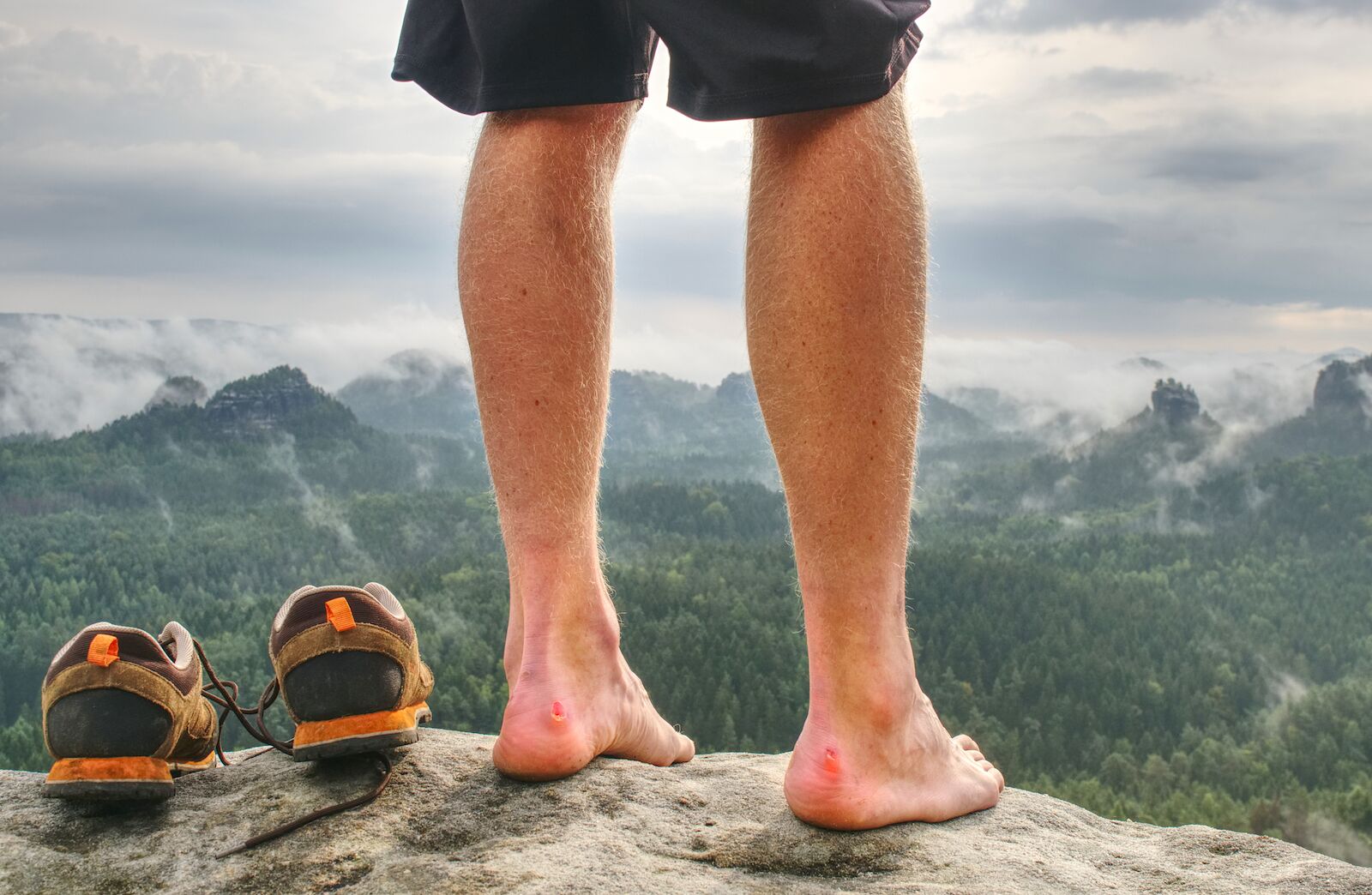 blisters on feet - beginner hiking tips